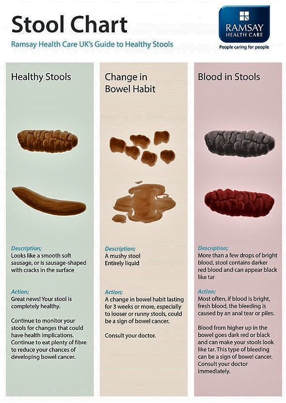 bowel-cancer-symptoms-signs-poo-stool-blood-uk-nhs-1323023